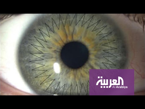 شاهد زرع قرنية العين بالليزر في دقائق