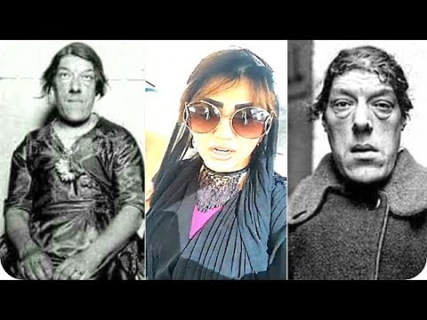 شاهد أميرة العباس تروي قصة أبشع امرأة في العالم