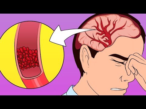 شاهد طريقة علمية لعلاج الصداع دون المسكنات