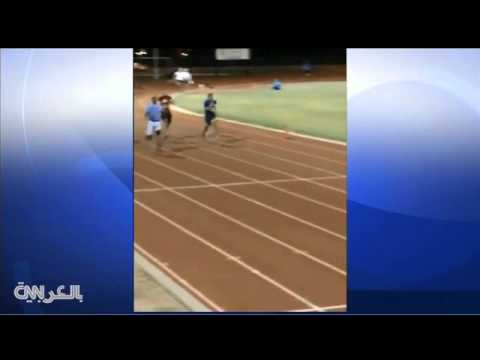 لص يسرق قدم صناعية لن تفيد إلا مالكها