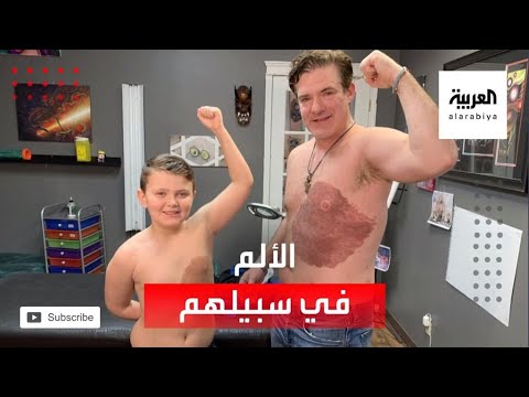 شاهد أب كندي يتحمَّل 30 ساعة من الألم لإسعاد ابنه