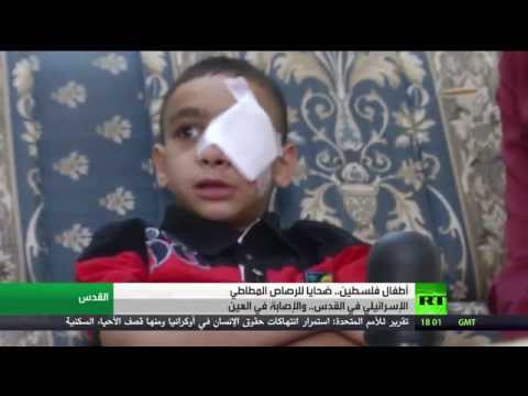 شاهد أطفال فلسطين ضحايا الرصاص المطاطي
