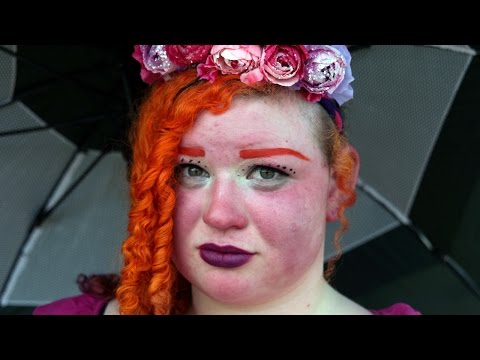 مرض جلدى نادر يجعل فتاة “تحترق” وهى على قيد الحياة