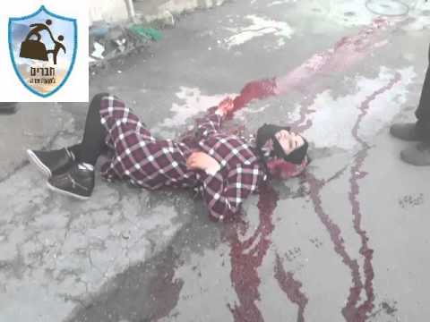 بالفيديومشهد مروع لطفلة فلسطينية تصارع الموت