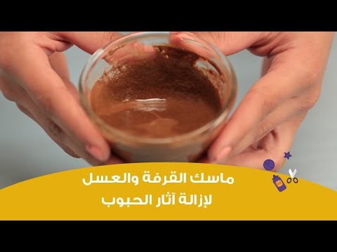 شاهد ماسك القرفة والعسل لإزالة آثار الحبوب