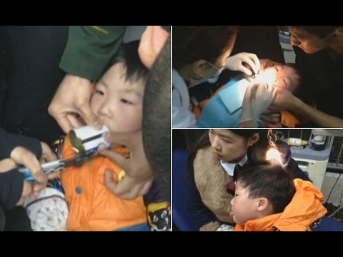 طفل كاد أن يفقد لسانه بسبب علبة