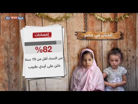شاهد تغليظ عقوبة الختان في مصر