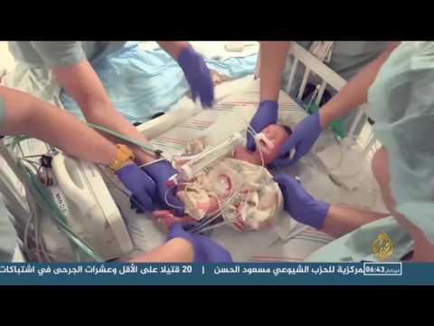 إنسان يولد مرتين في ولاية هيوستن الأميركية