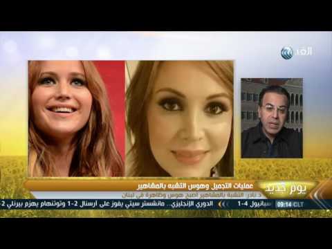 أخصائي تجميل يوضح سر التشبه بالمشاهير